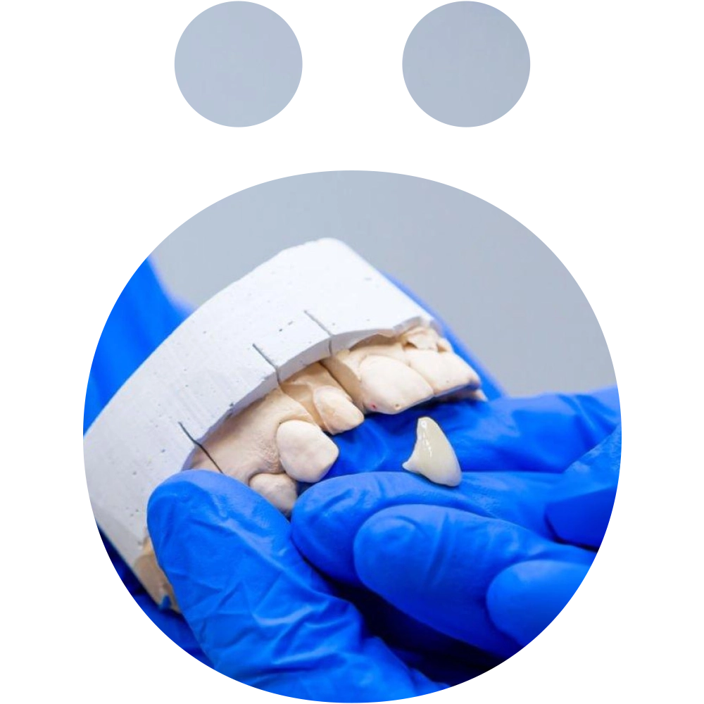 Dental Crowns and Bridges - Snö Clinics | Abu Dhabi