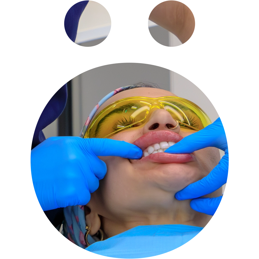 Dental Exam - Snö Clinics | Abu Dhabi