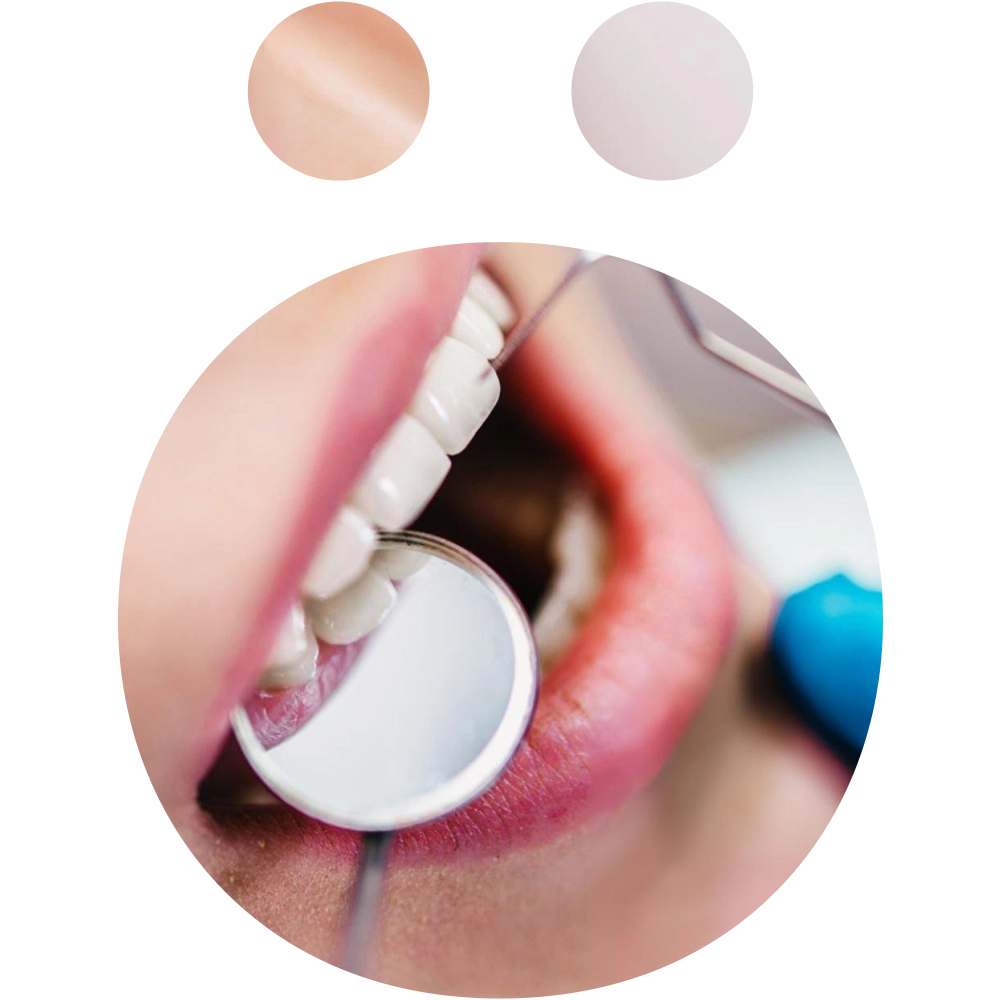 Gum Disease Treatment - Snö Clinics | Abu Dhabi