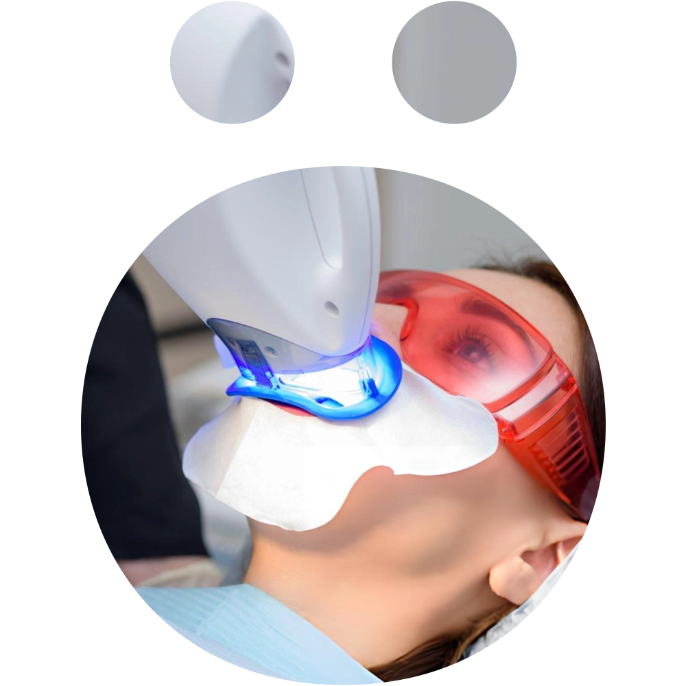 Teeth whitening - Snö Clinics | Abu Dhabi