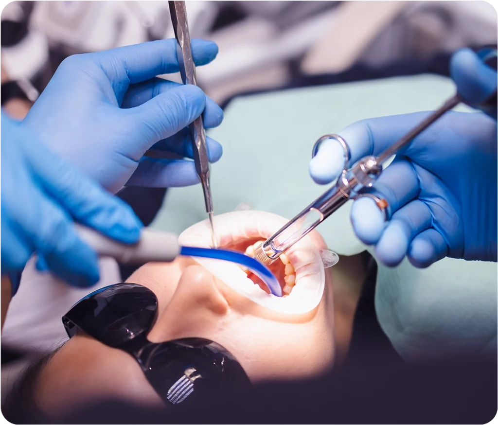 extration - Snö Clinics | Abu Dhabi