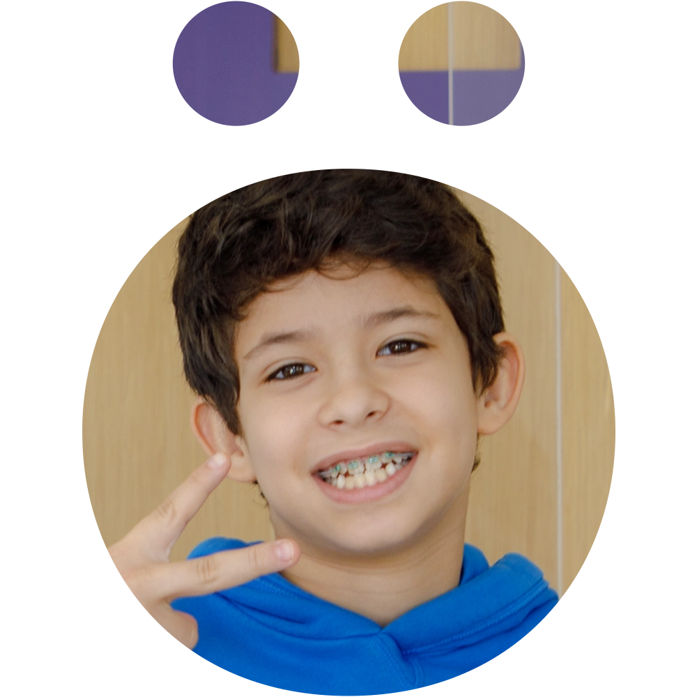 fixed braces 1 - Snö Clinics | Abu Dhabi