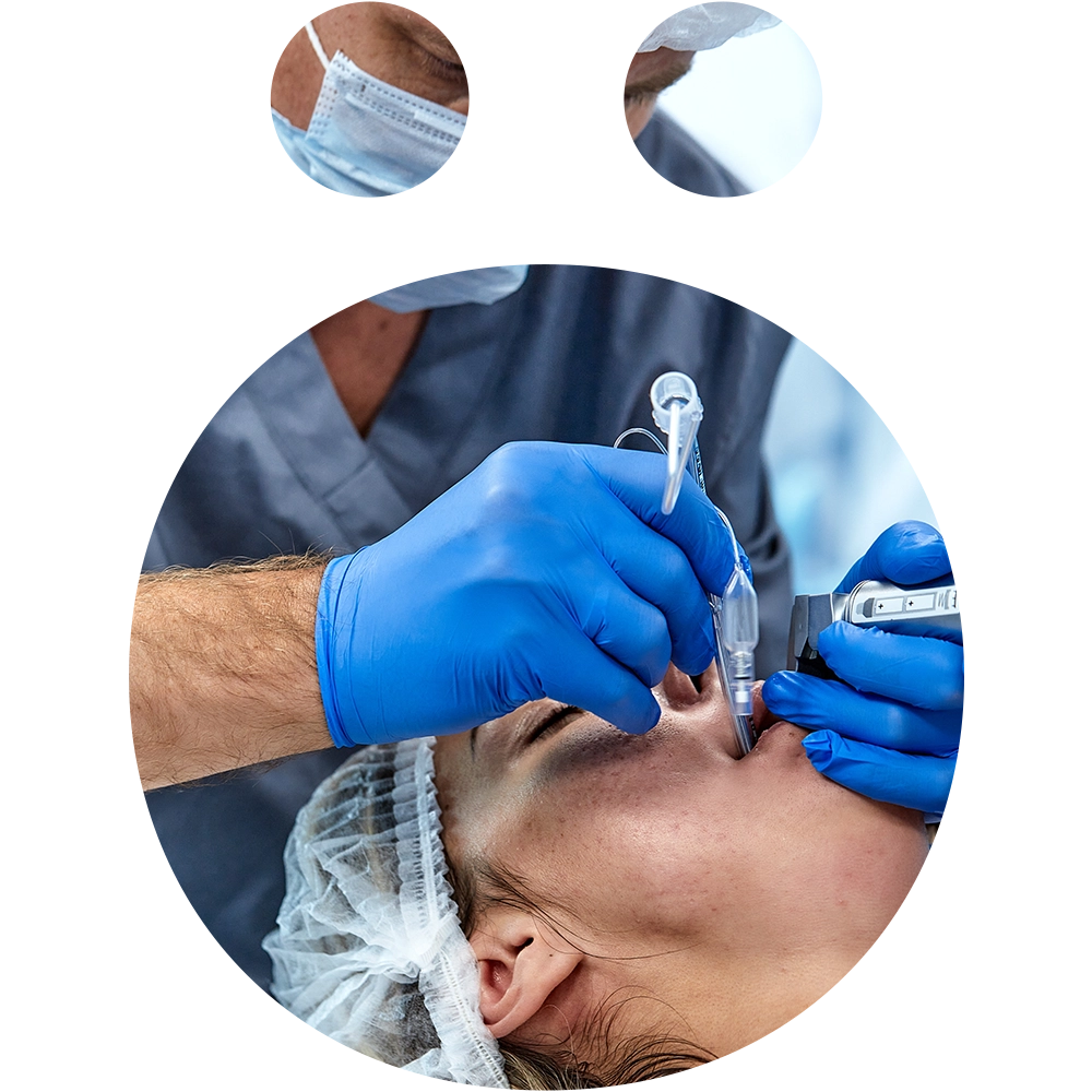 tooth extraction - Snö Clinics | Abu Dhabi