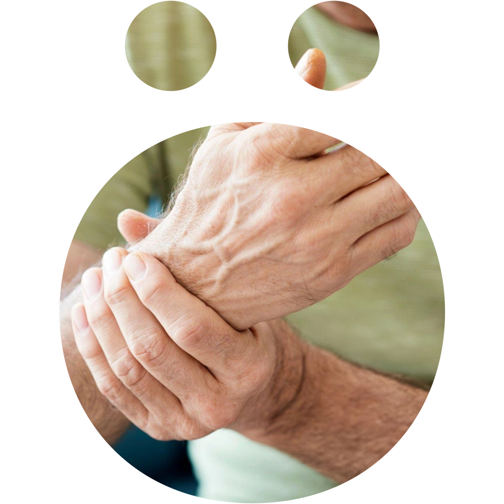 Arthritis Physiotherapy Treatment at SNO Clinics Abu Dhabi - Snö Clinics | Abu Dhabi At SNO Clinics Abu Dhabi, we specialize in comprehensive physiotherapy solutions for individuals dealing with arthritis. Our experienced team is dedicated to helping you manage symptoms, improve joint function, and enhance your quality of life.