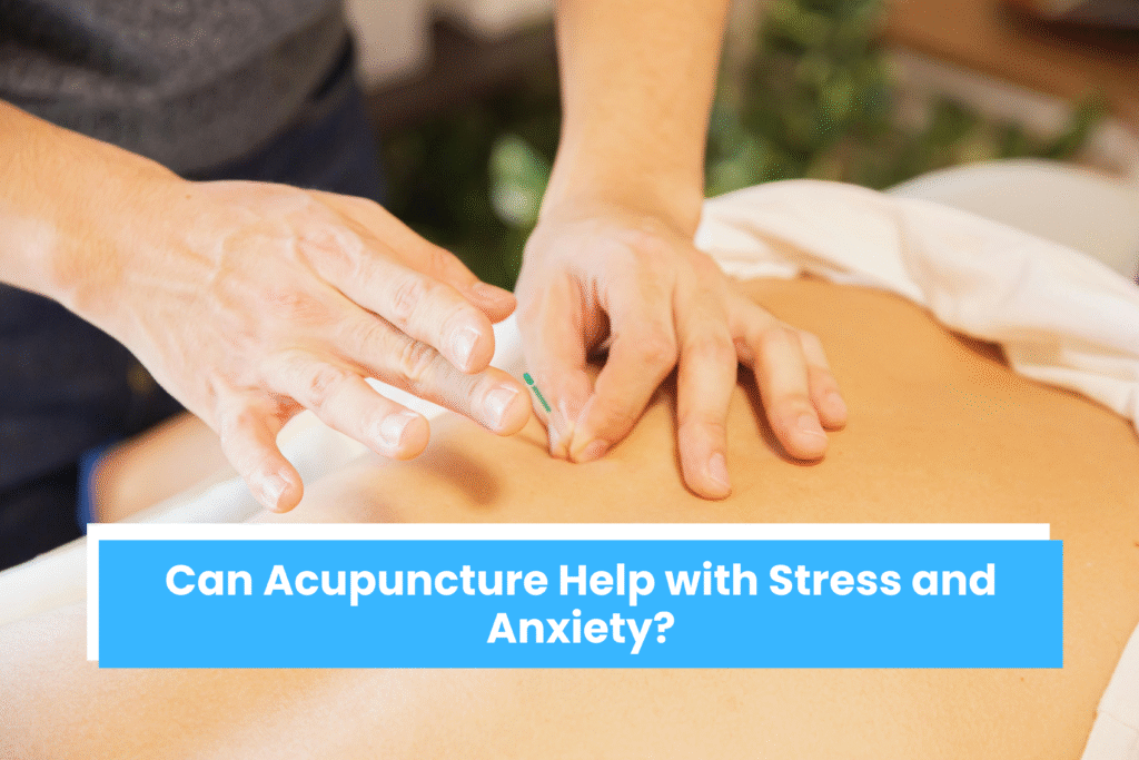 Can Acupuncture Help with Stress and Anxiety?