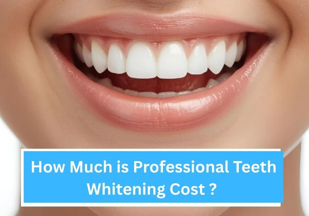 How Much is Professional Teeth Whitening