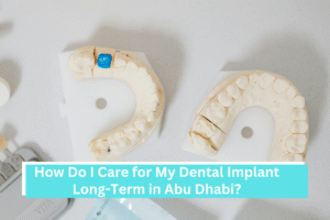 How Do I Care for My Dental Implant Long-Term in Abu Dhabi?