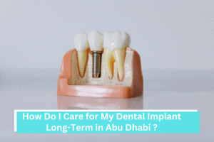 How Do I Care for My Dental Implant Long-Term in Abu Dhabi (Maintenance, Risks, Longevity)?