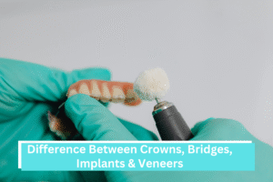 Difference Between Crowns, Bridges, Implants & Veneers