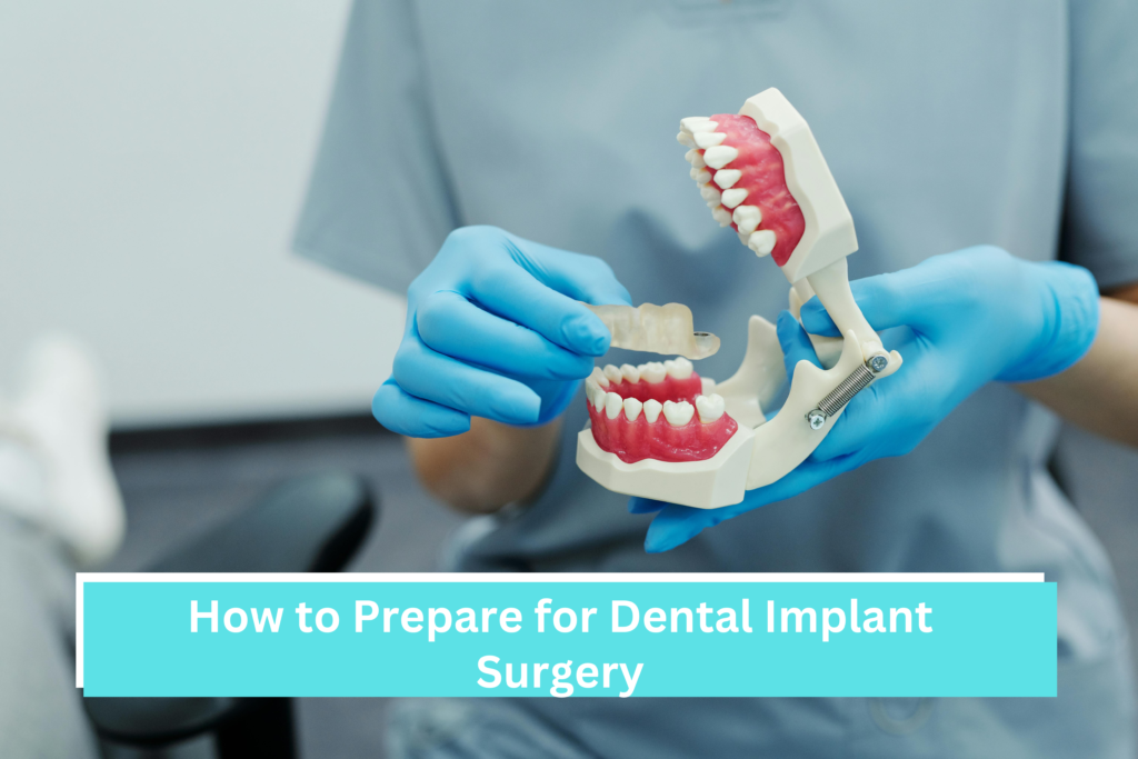 How to Prepare for Dental Implant Surgery