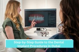 Step-by-Step Guide to the Dental Implant Procedures in Dubai