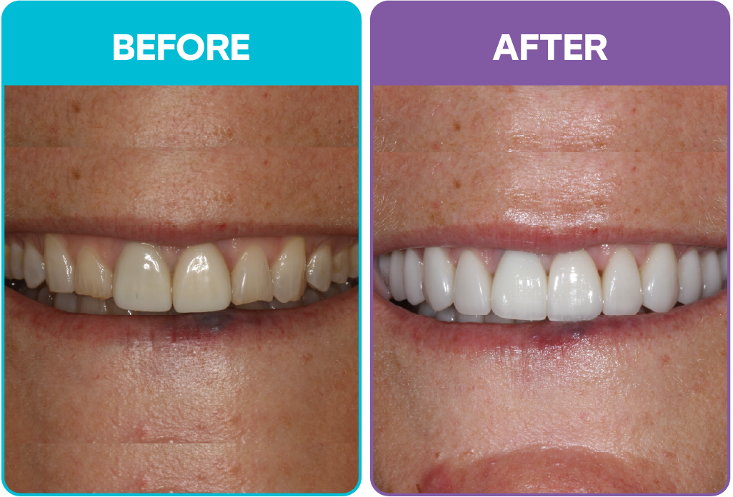 Aris - Before and afters-01