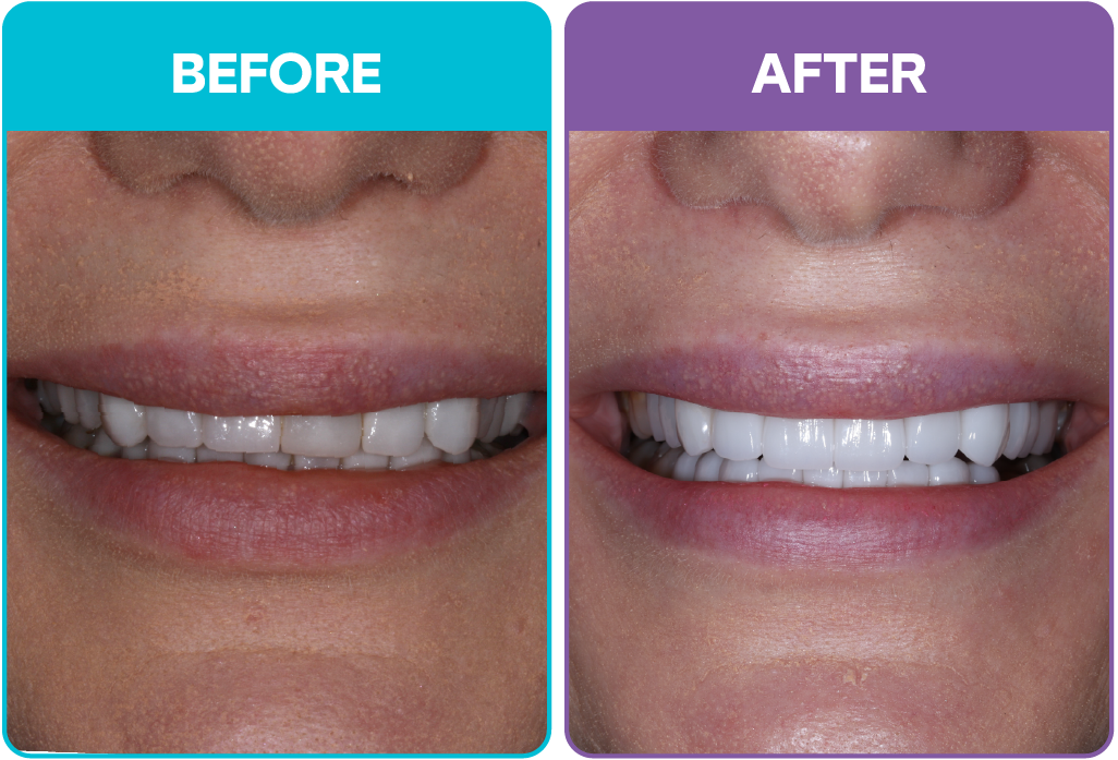 Aris - Before and afters-02