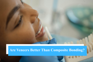 Are Veneers Better Than Composite Bonding?
