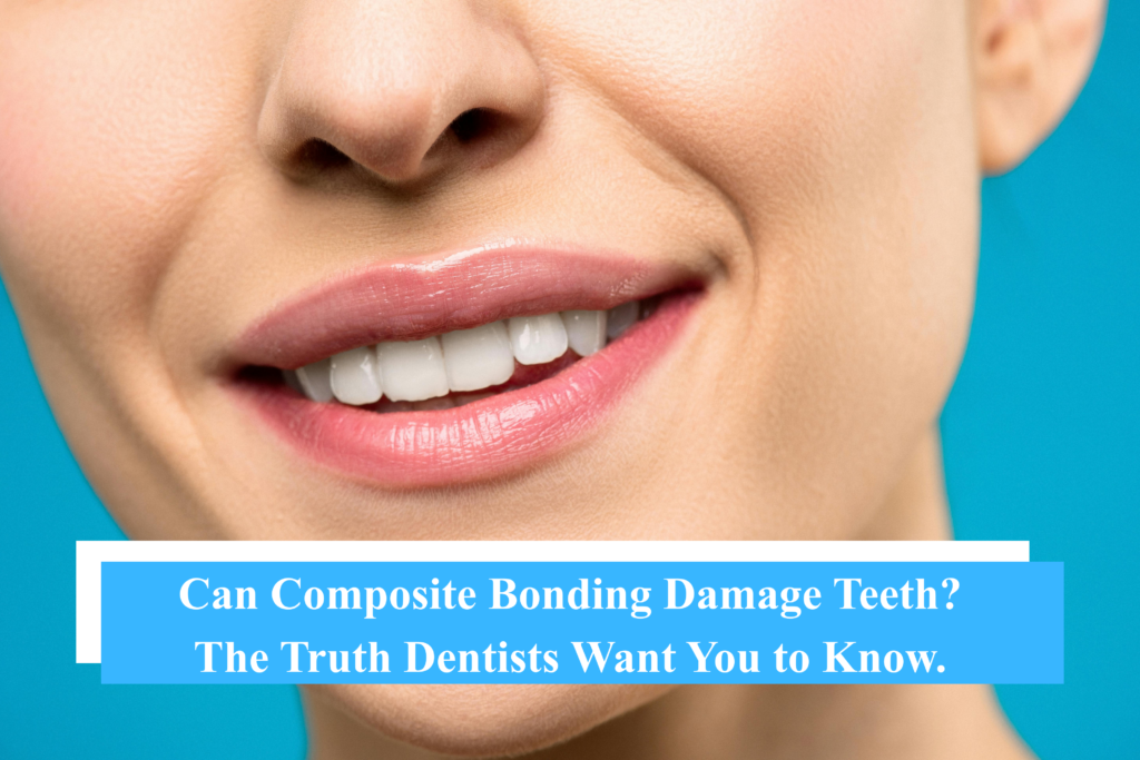 Can Composite Bonding Damage Teeth