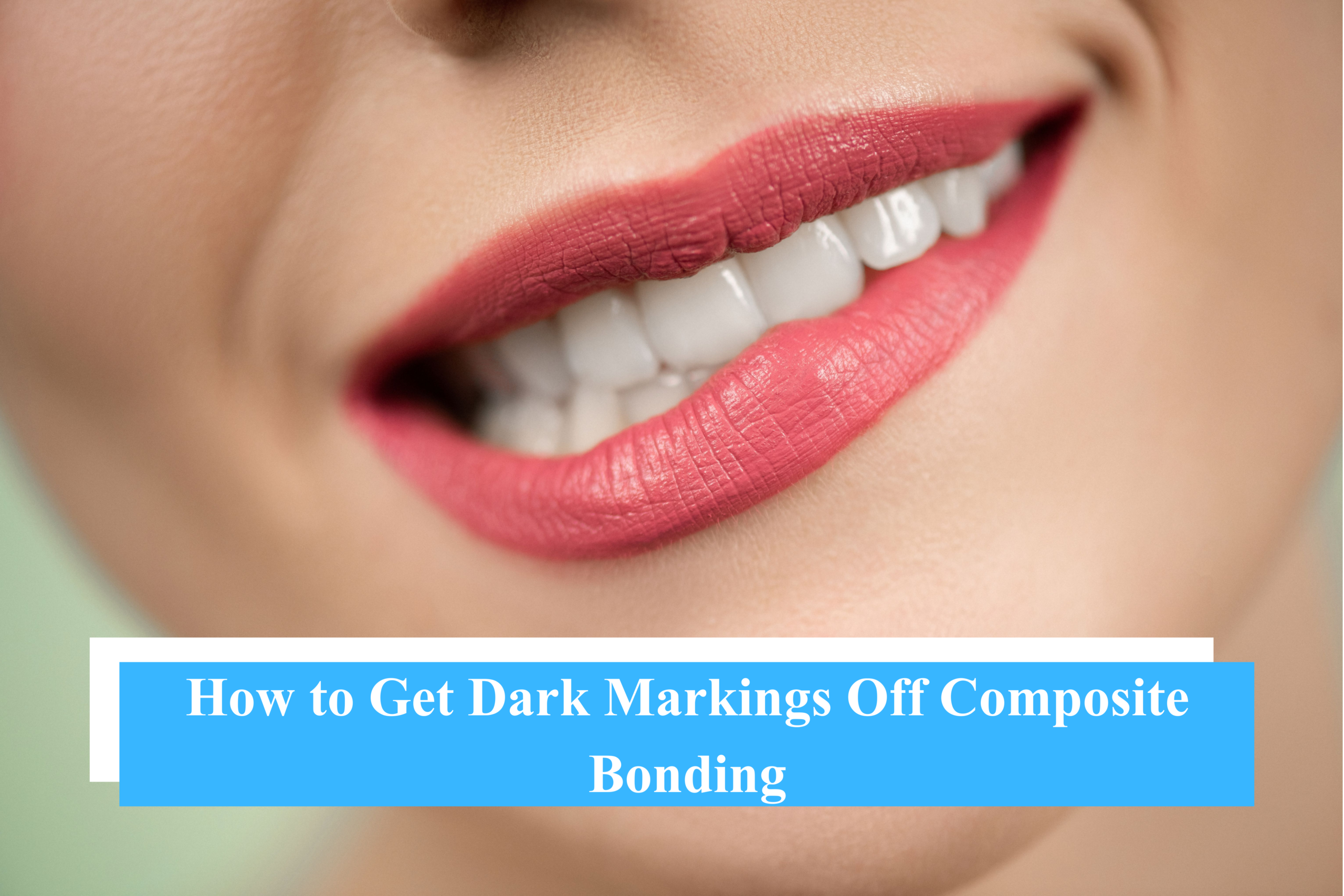 How Technology is Used in Physiotherapy in Abu Dhabi 6 - Snö Clinics | Abu Dhabi Dark Markings Off Composite Bonding