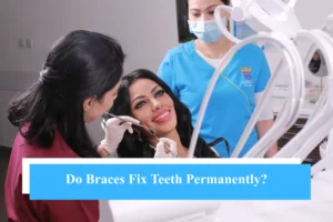 Do Braces Fix Teeth Permanently? - Snö Clinics | Abu Dhabi - Snö Clinics | Abu Dhabi Do Braces Fix Teeth Permanently?