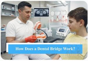 How Does a Dental Bridge Work - Snö Clinics | Abu Dhabi - Snö Clinics | Abu Dhabi How Does a Dental Bridge Work