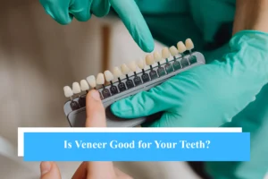 Is Veneer Good for Your Teeth? - Snö Clinics | Abu Dhabi - Snö Clinics | Abu Dhabi Is Veneer Good for Your Teeth?