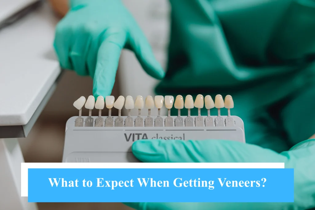 What to Expect When Getting Veneers?