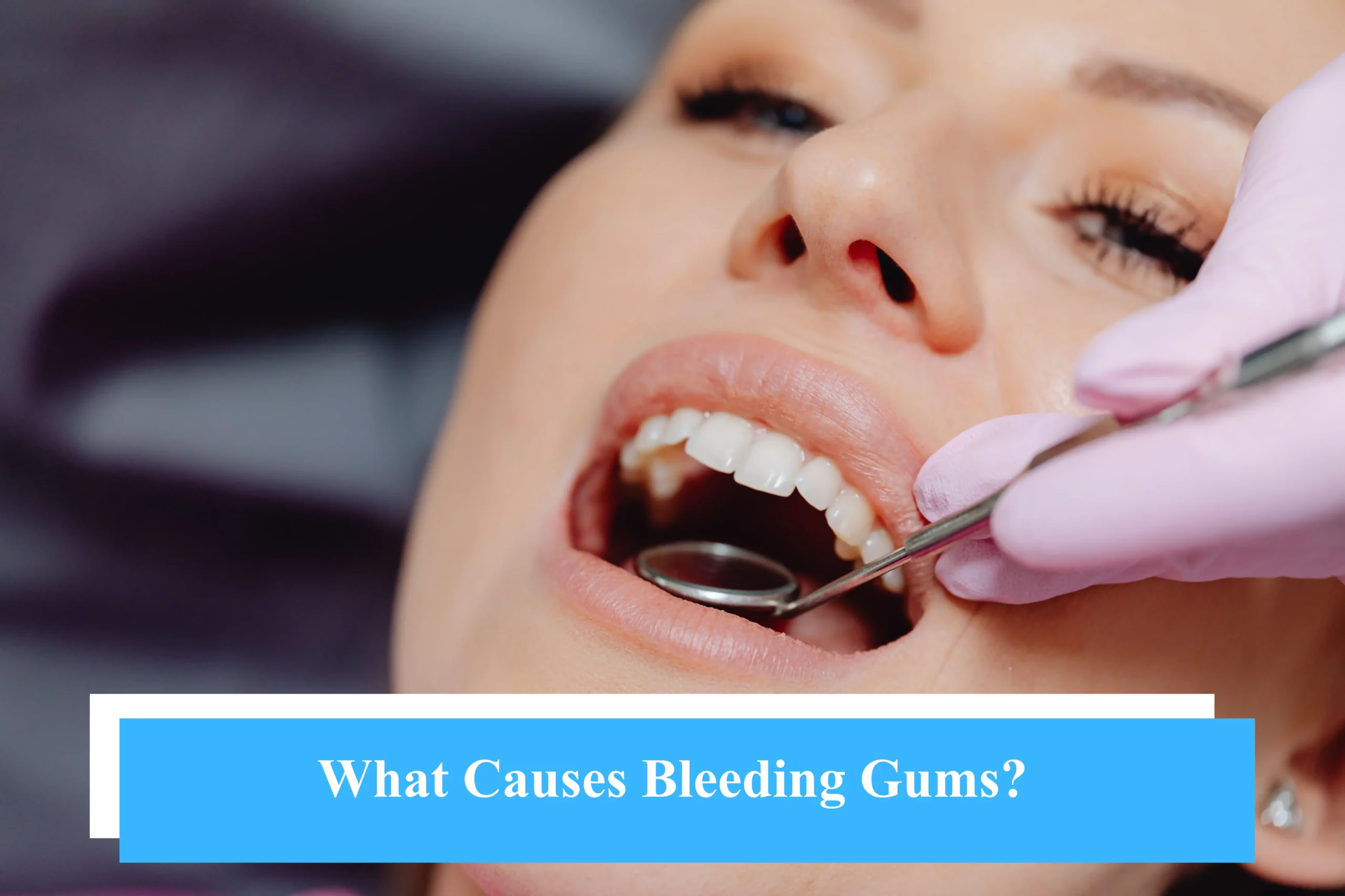What Causes Bleeding Gums?