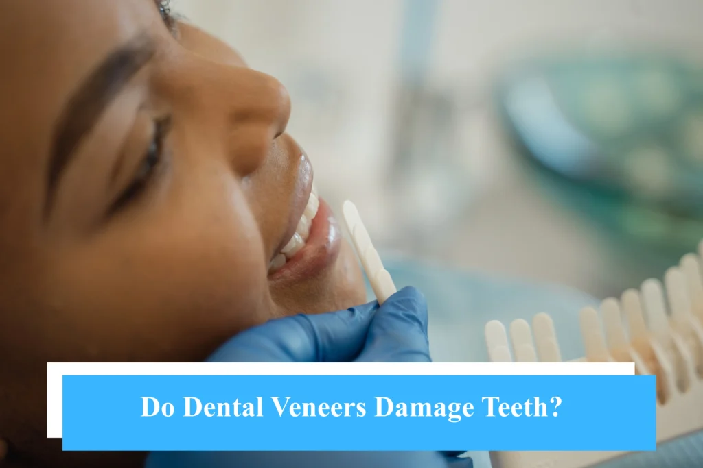 Do Dental Veneers Damage Teeth?