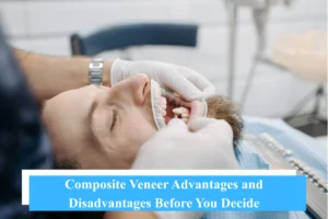 Composite Veneer Advantages and Disadvantages - Snö Clinics | Abu Dhabi - Snö Clinics | Abu Dhabi Composite Veneer Advantages and Disadvantages