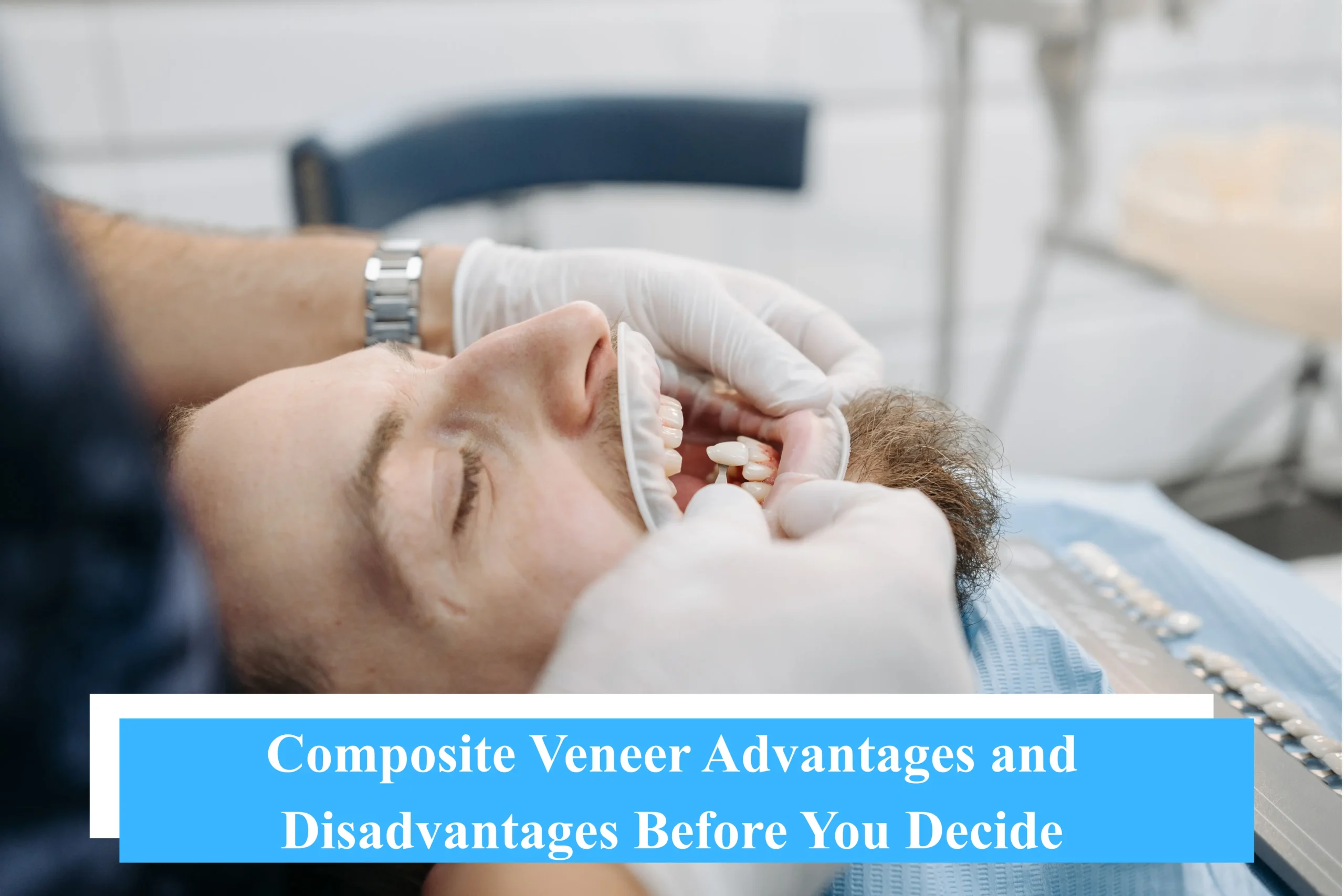 Composite Veneer Advantages and Disadvantages